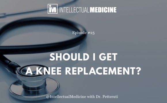 Should I Get a Knee Replacement? Should I Get a Knee Replacement?